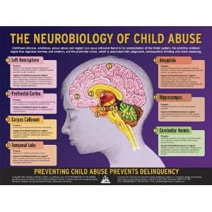  The Neurobiology of Child Abuse Toys & Games