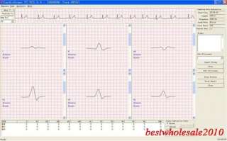 HRV Heart Rate Variability (time domain, 3 D frequency domain 