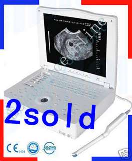 LAPTOP ULTRASOUND SCANNER/MACHINE+ transvaginal PROBE RUS 9000E  