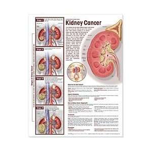  Understanding Kidney Cancer Chart Industrial & Scientific