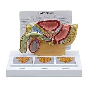 Male Pelvis Model with 3D Prostate Frame  Industrial 